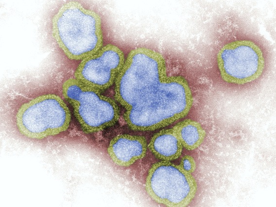 Microscopic view of Influenza Virus 