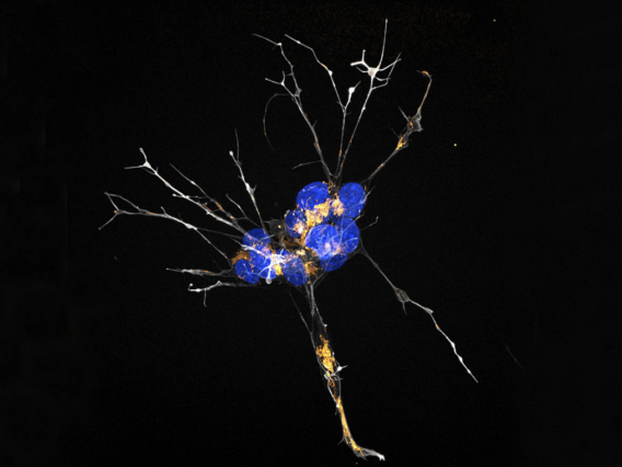 Rendition of brain cells brain during menopause colored white, blue, orange