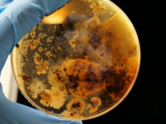 Bacteria growing in a petrie dish.