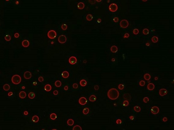 Yeast with a red fluorescent protein marking the vacuole - the nutrient storage compartment of the cell - and a green fluorescent protein marking aggregates of TORC1 that form in cells missing Ait1.