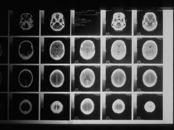 Brain scans