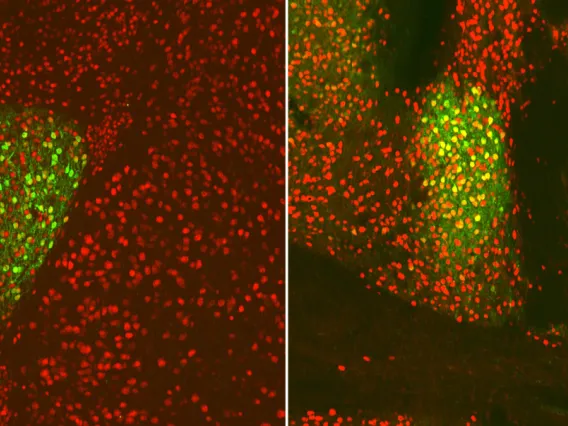 Neurons glowing green with brain imagery