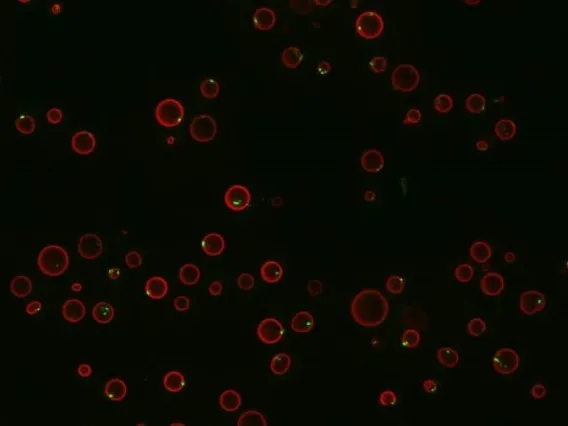 Yeast cells fluorescing red