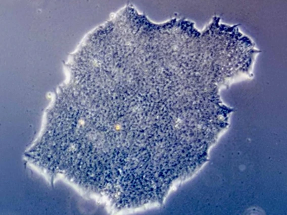 Microscopic view of a human embryonic stem cell colony.