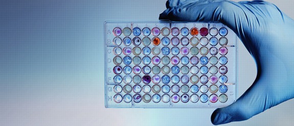 a person wearing a blue glove holding a 96-well tissue culture plate