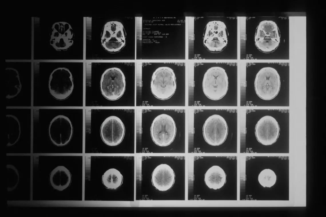 Brain scans