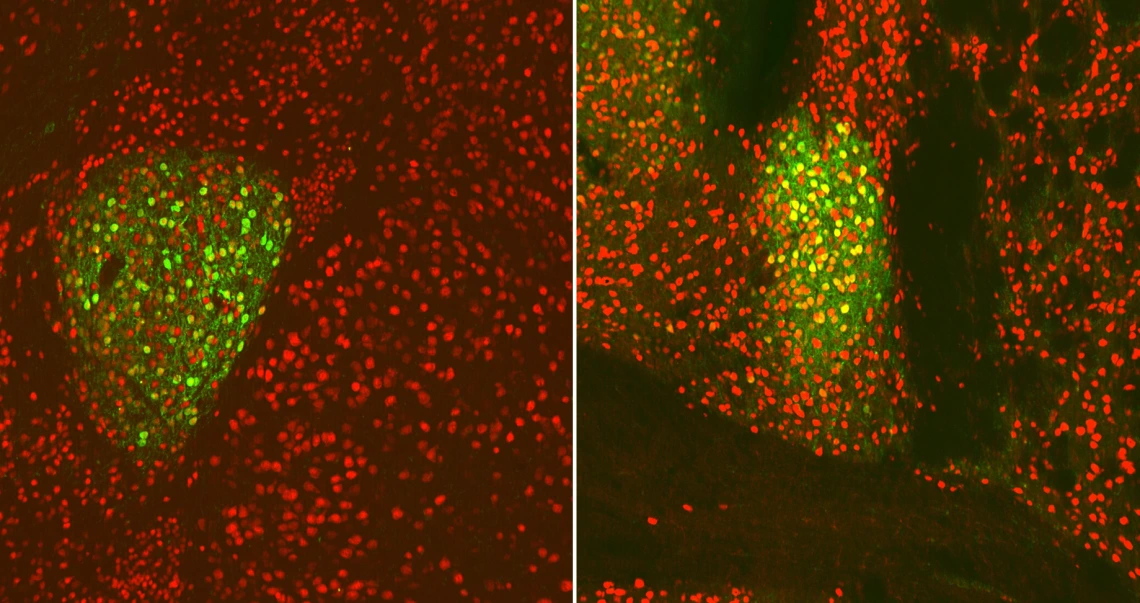 Neurons glowing green with brain imagery