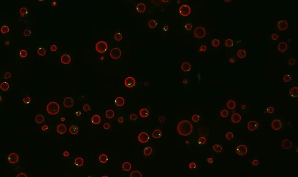 Yeast cells fluorescing red