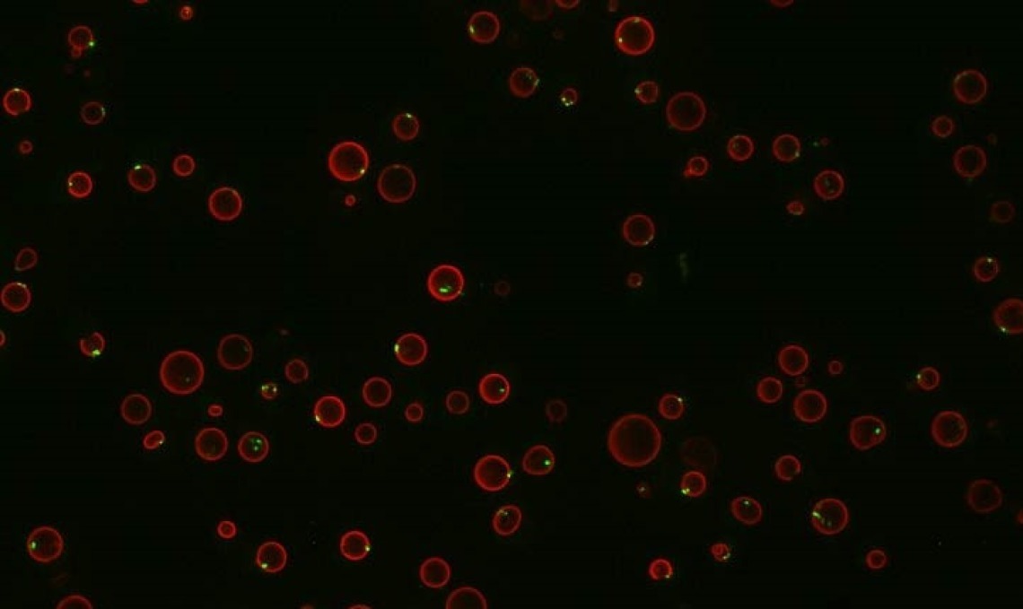 Yeast cells fluorescing red