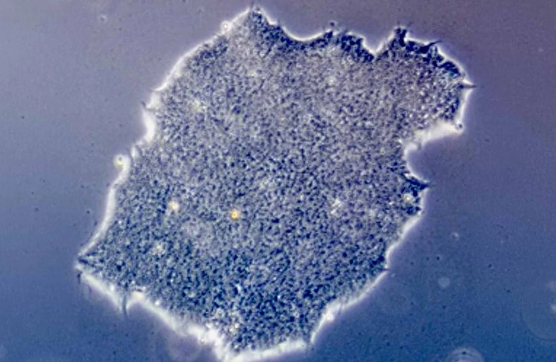 Microscopic view of a human embryonic stem cell colony.