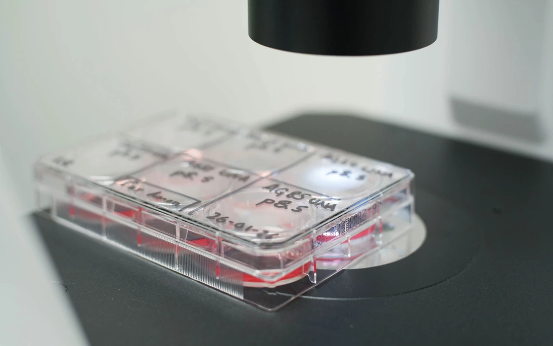 A microscope slide holder containing labeled clear compartments sits under a microscope lens.