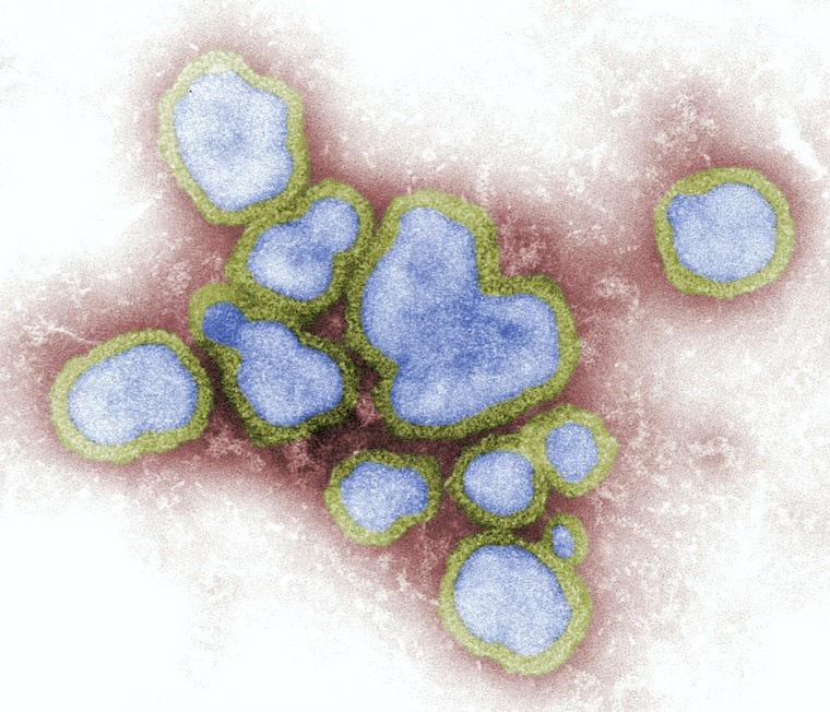 Microscopic view of Influenza Virus 