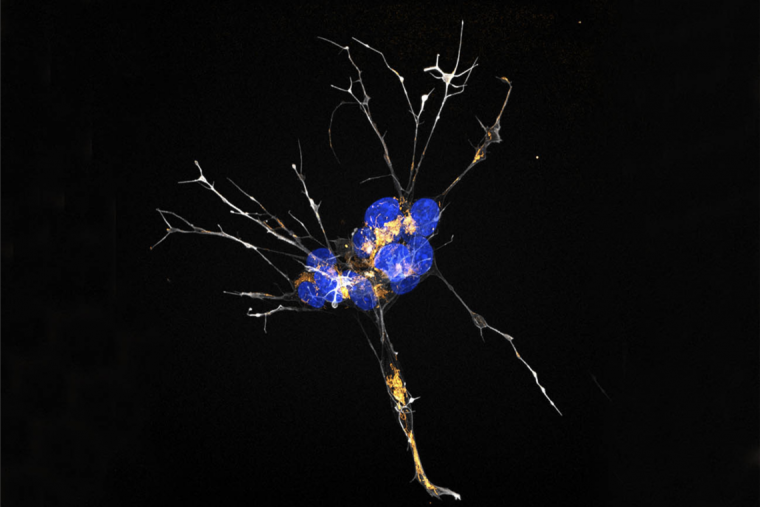 Rendition of brain cells brain during menopause colored white, blue, orange