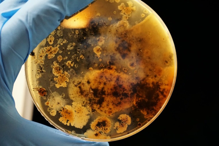 Bacteria growing in a petrie dish.
