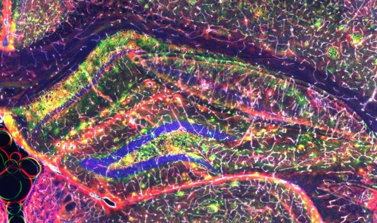 Microscopic image of part of the right brain hemisphere from a humanized mouse model of Alzheimer’s disease showing amyloid-beta plaques in green and blood vessels in red.