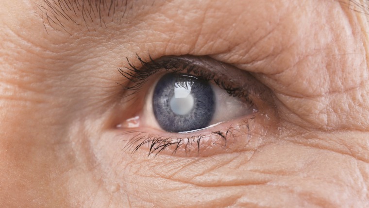 Close-up image of an eye.