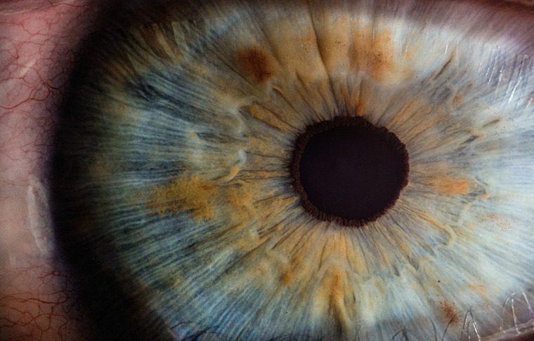 Eyeball closeup