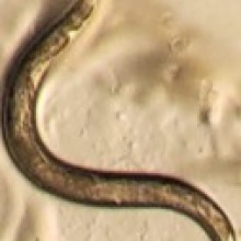 C elegans worm