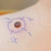 Close-up of a skin mole circled with a blue marker on human skin, likely marked for medical examination.